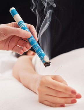 Moxibustion | Susanne Jahnke Heilpraktikerin